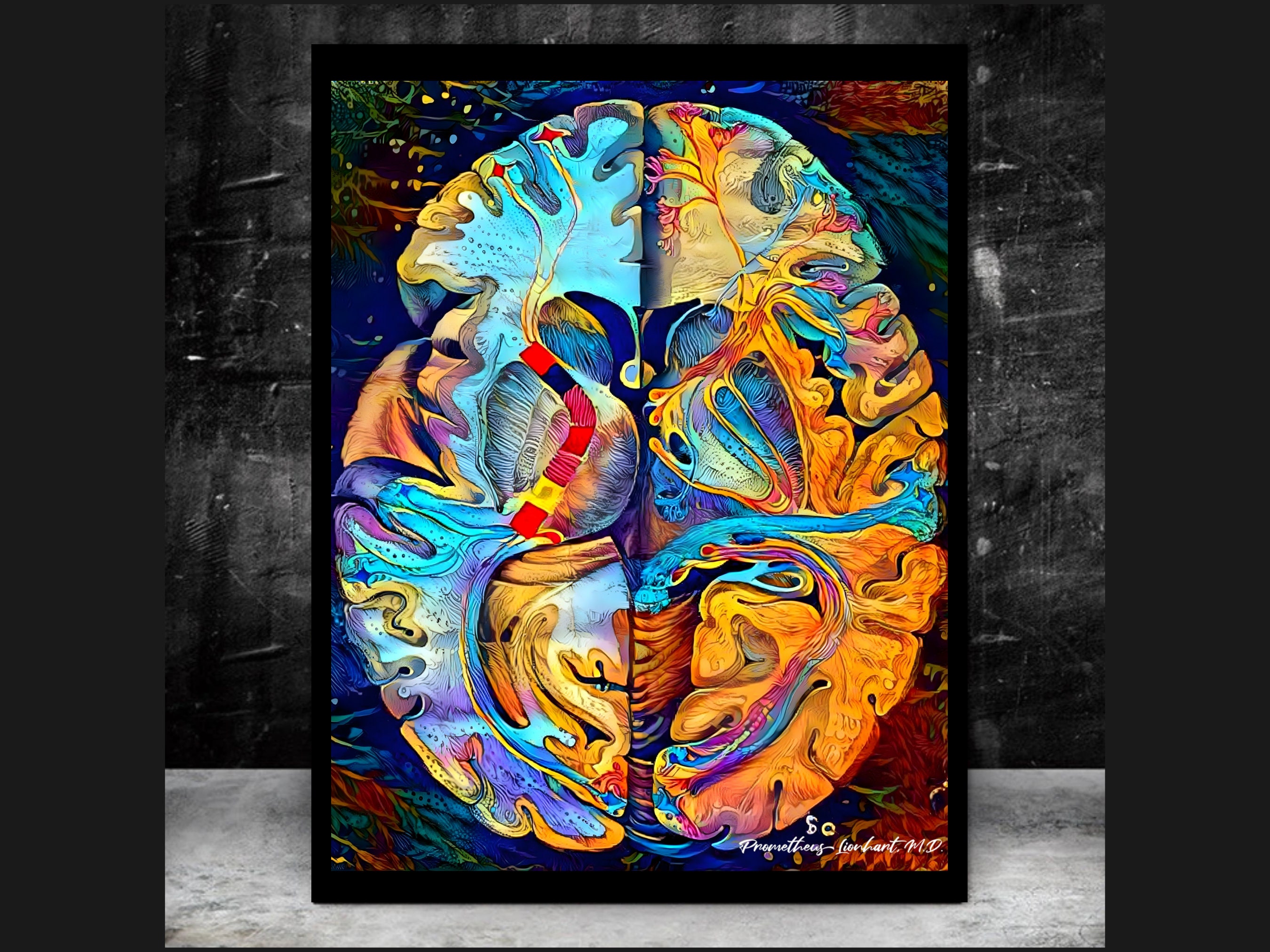 Brain Anatomy Art Canvas White Matter Map Version Radiology Etsy