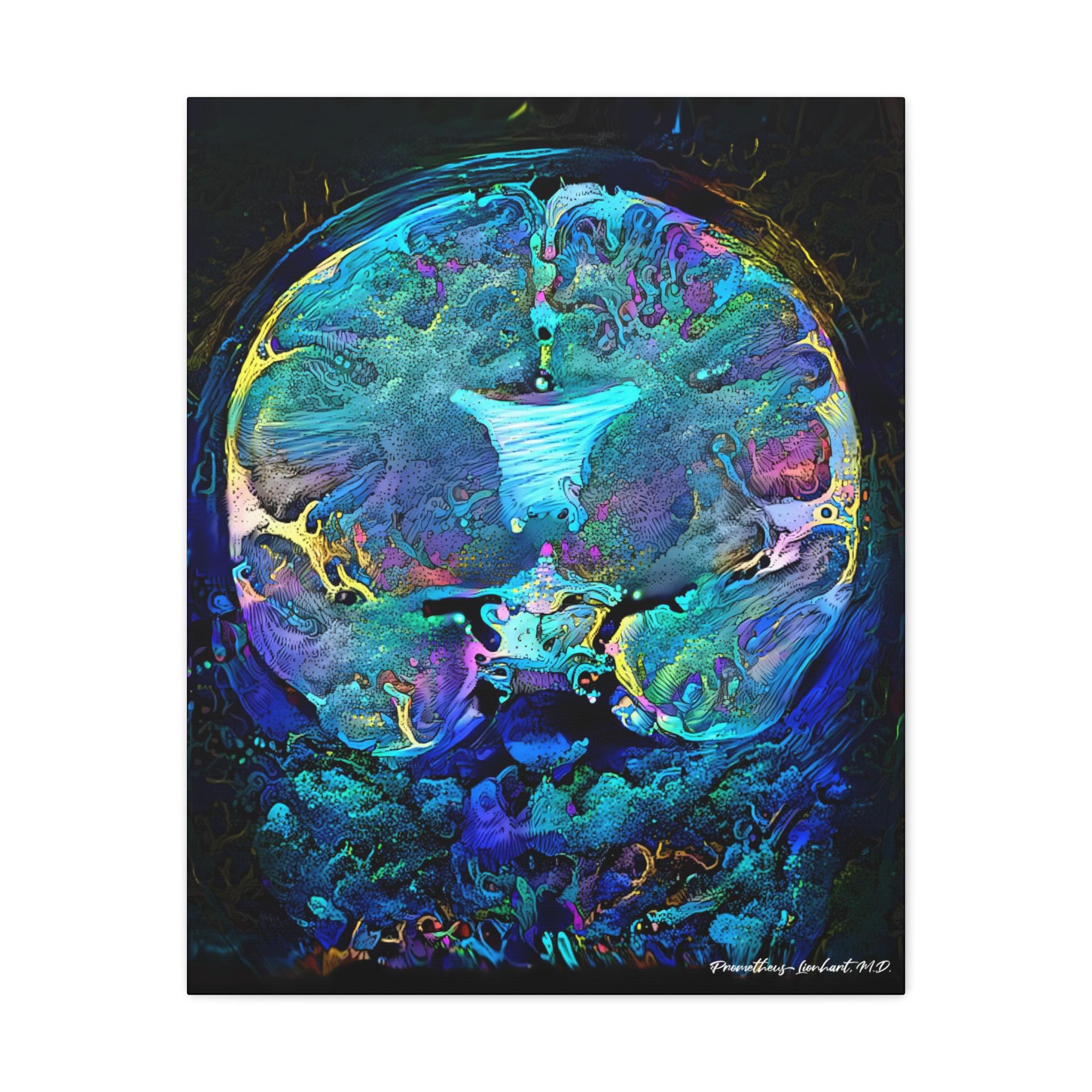 Brain Anatomy Art, Ready to Hang Canvas, Radiology Wall Art