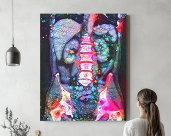 Abdominal Anatomy Art, Canvas, -  Kidney Radiology Wall Pop Art Science Medical Art Student Art Office Decor Gifts Medicine