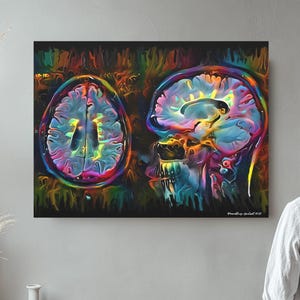 Op de afbeelding: Een kleurrijk abstract schilderij van een menselijk brein, met aan de ene kant een doorsnede en aan de andere kant een zijaanzicht.