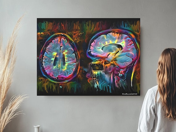 Multiple Sclerosis MS Wall Art - Brain Art - Bright Color Canvas