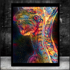 Neck and Brain Anatomy - Canvas -  ENT Neurosurgery Radiology Orthopedics Art Science Medical Student Office Medicine