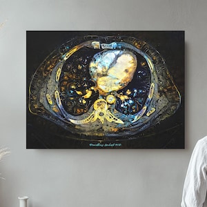 Chest Lung Pulmonary Art, Canvas, Anatomy Radiology Art Science Medical Student Medicine Thoracic