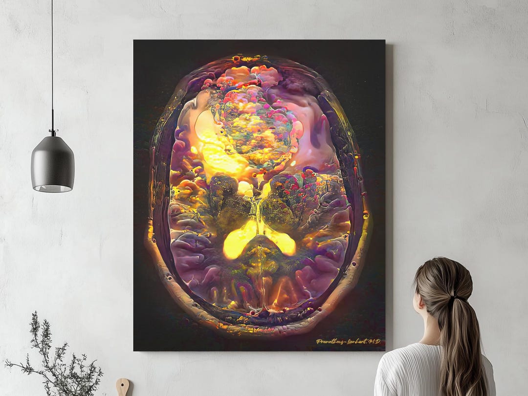 Brain Anatomy Brain Tumor, Ready to Hang Canvas, Radiology