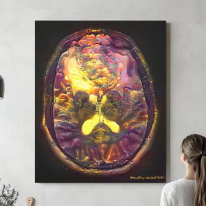 Brain Anatomy Brain Tumor, Ready to Hang Canvas, Radiology Neurology Neurosurgery Neuroscience Art Science Medical Student Medicine