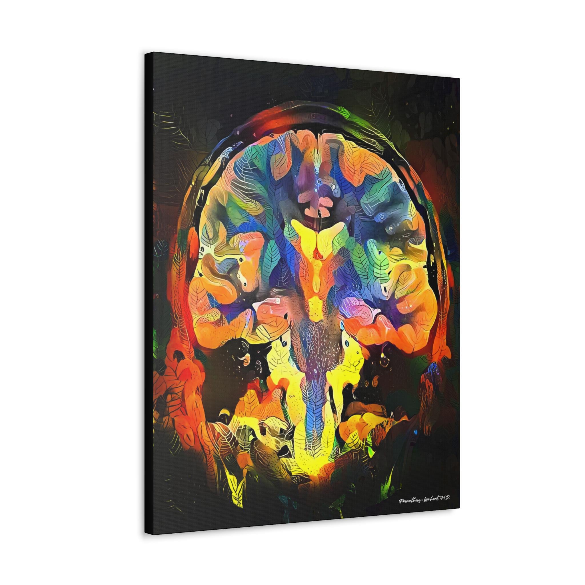 Brain Anatomy Art, Ready to Hang Canvas, Radiology Wall Art