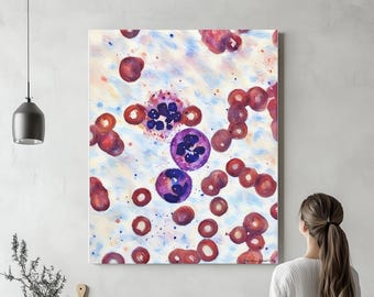 巨赤芽球性貧血アートキャンバス、ポスター、またはアクリルガラス。骨髄、血液学アート、病理学アート、組織技術ギフト、血液学ギフト、