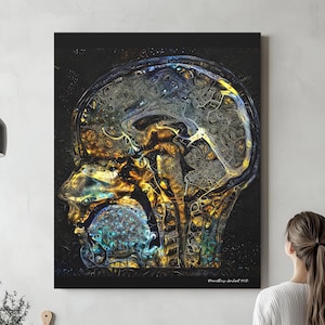 Brain Anatomy Art - Ready to Hang Canvas, Radiology Wall Decor, Medical Science Gifts for Students and Offices