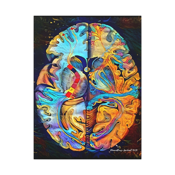Brain Anatomy Art, Canvas or Acrylic, “alba Materia Cerebri