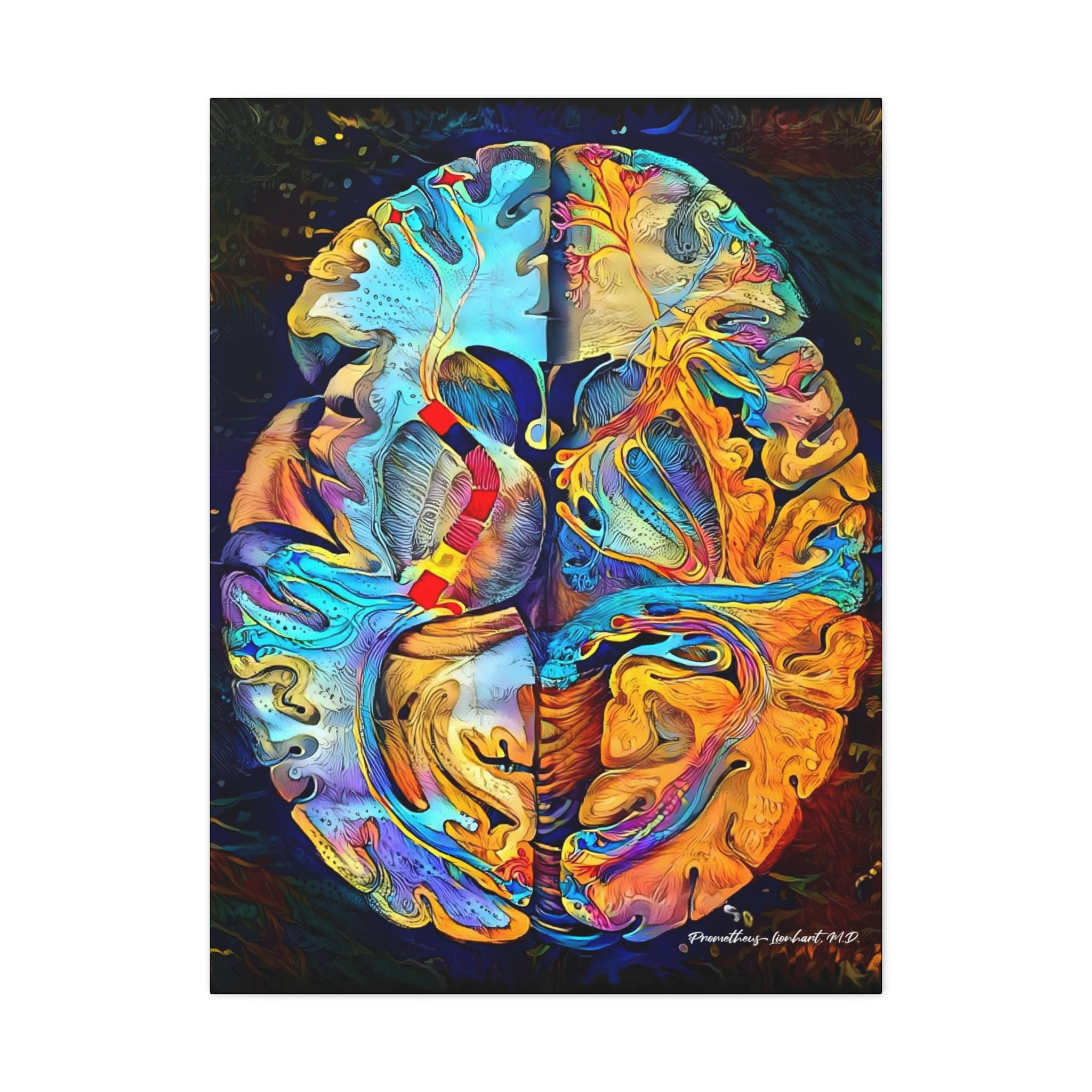 Brain Anatomy Art, Canvas or Acrylic, “alba Materia Cerebri