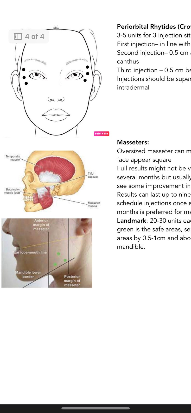 Landmarking Botox/ Neurotoxin Landmarking Tool Cheat Sheet Printable Nurse ...