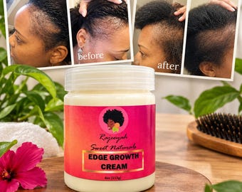Hair Growth Cream | Hair Loss, Handmade with Jamaican Black Castor Oil