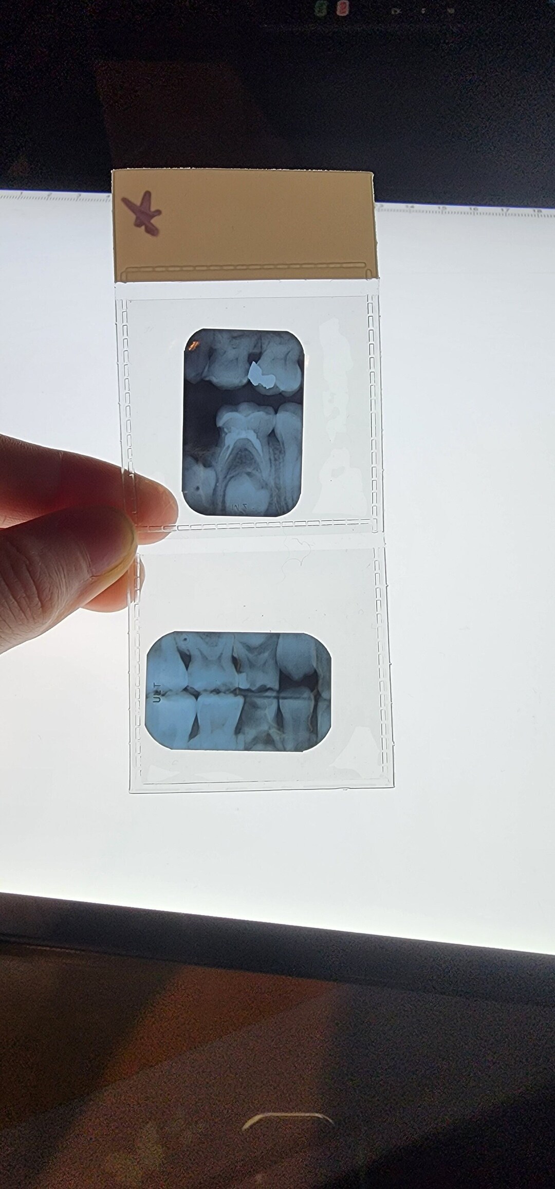 Vintage Dental Xrays Xray Film Radiograph Dentistry Curiosities