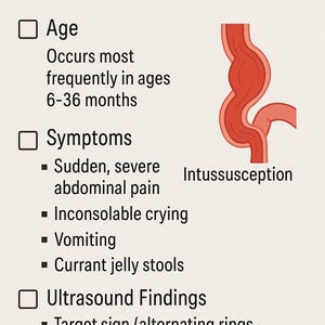 May include: A medical illustration depicting intussusception, a condition where one part of the intestine slides into another. The illustration shows a red, folded section of the intestine. The text describes the condition, including age of onset, symptoms, and ultrasound findings.