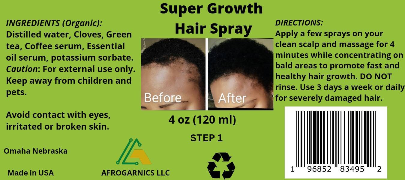 Cloves Supergrowth Hair Spray to Reverse Traction Alopecia Etsy