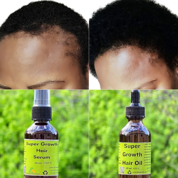 Cloves Super growth hair oil (Step 2)