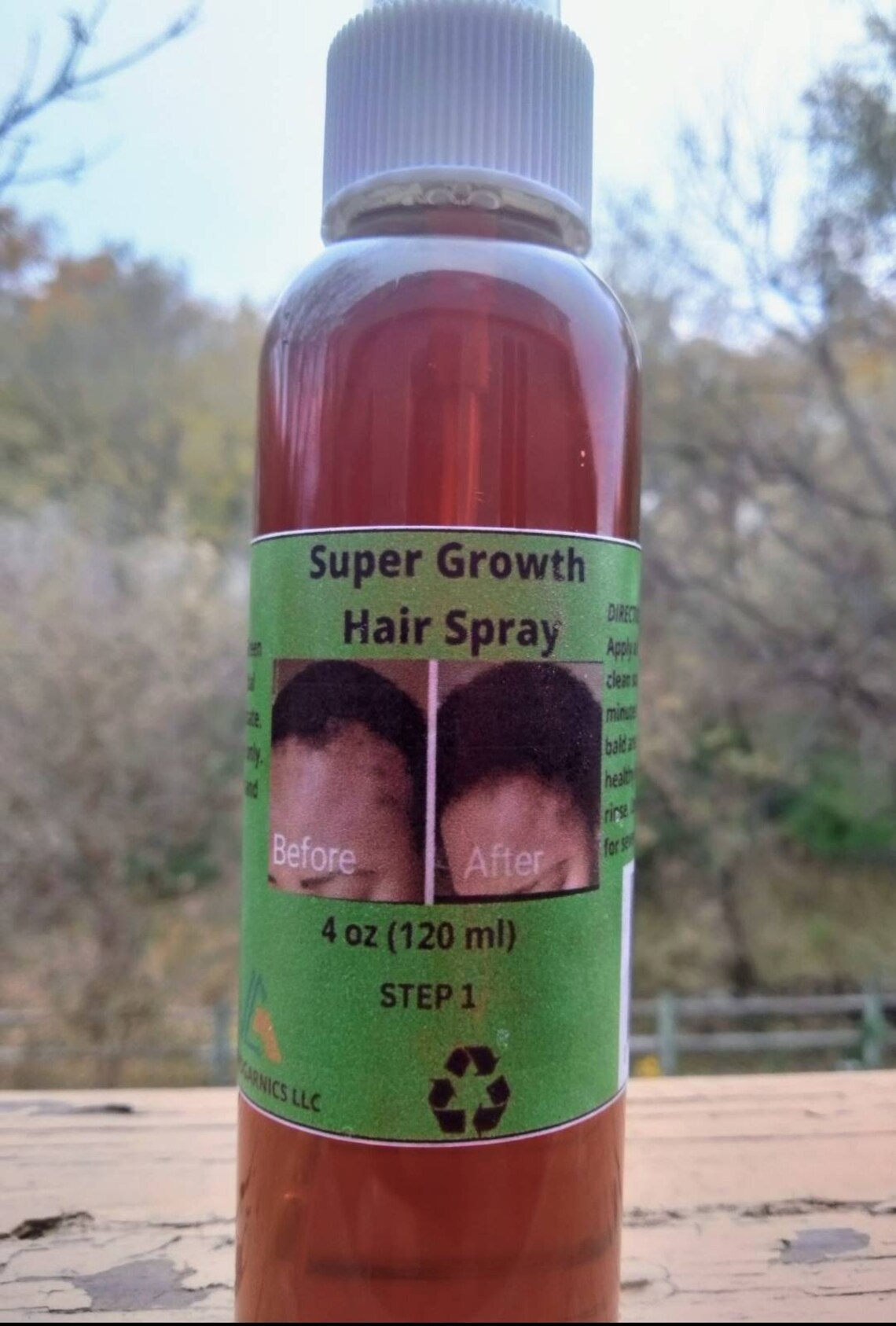 Cloves Supergrowth Hair Spray to Reverse Traction Alopecia and Severe