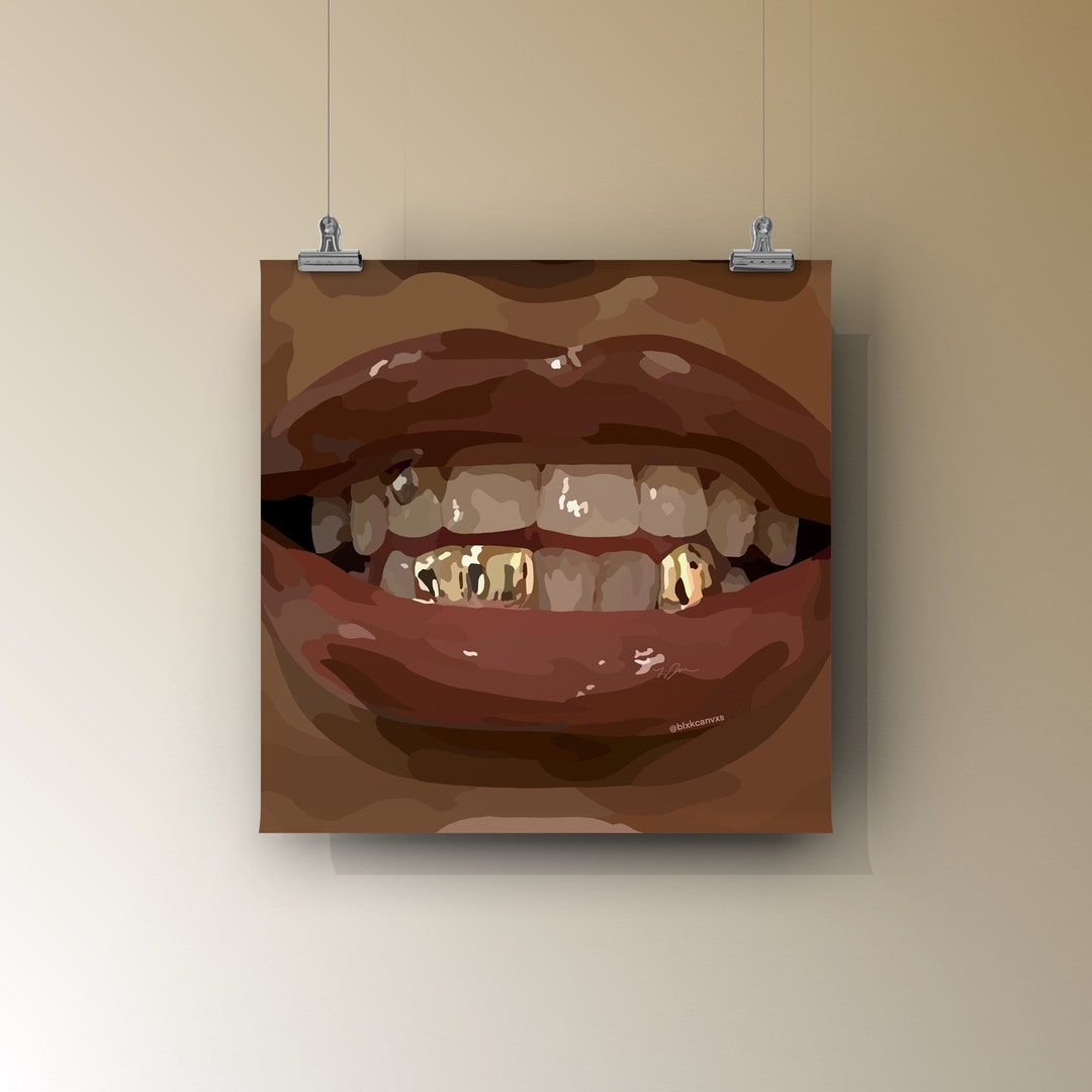 Gold Grills Art Poster | Black Woman Glossy Lips Print - Etsy