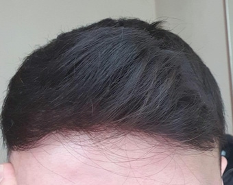 Men's Lace Front Toupee – 100% Human Natural Hairpiece for Hair Replacement