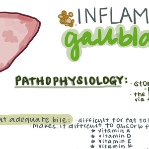 Gallbladder Disease
