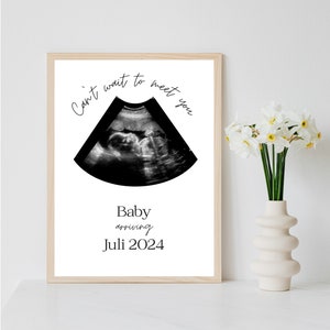 Poster Ultraschallbild personalisiert | Schwangerschaft verkünden per PDF Datei oder ausgedruckt A4 optional mit Bilderrahmen
