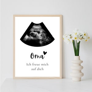 Poster Ultraschallbild personalisiert | Schwangerschaft verkünden per PDF Datei oder ausgedruckt A4 optional mit Bilderrahmen