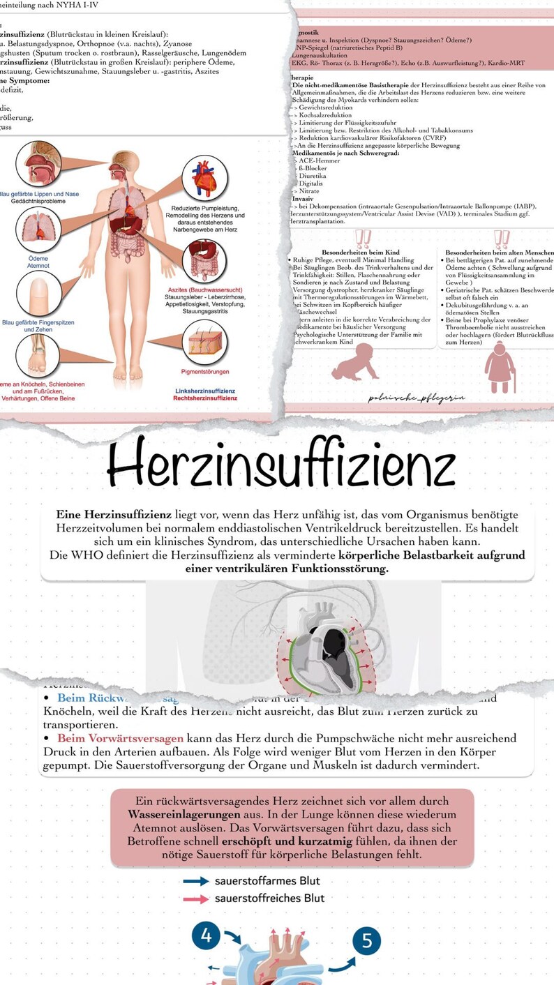 Herzinsuffizienz Zusammenfassung / Lernzettel / - Etsy.de