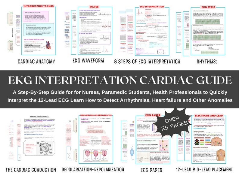 EKG Interpretation Guide – ECG Arrhythmia Cheat Sheets (digital ...