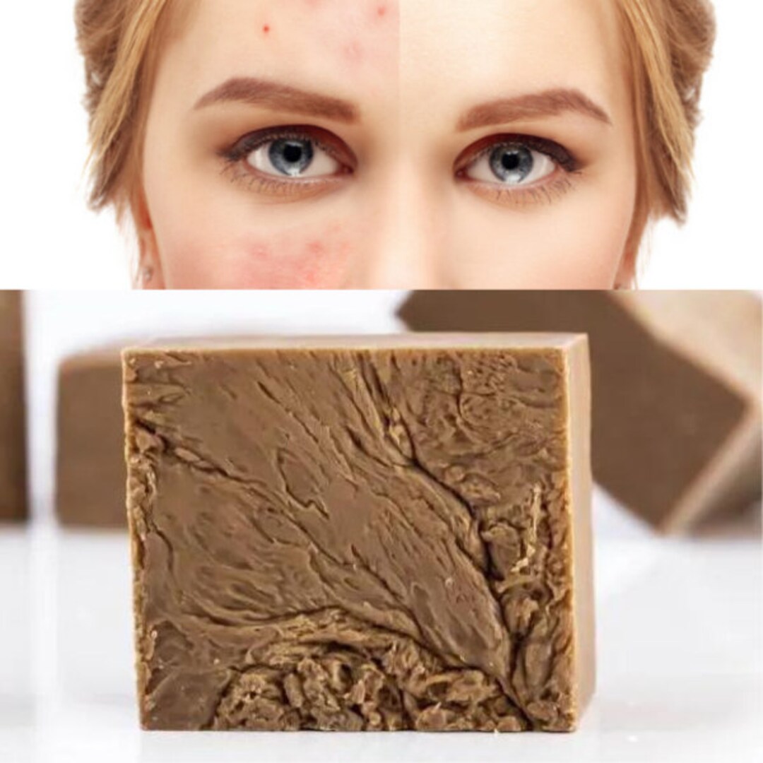 Pine Tar Soap, Acne Treatment, Handmade Pine Tar Soap, 1 Piece Natural