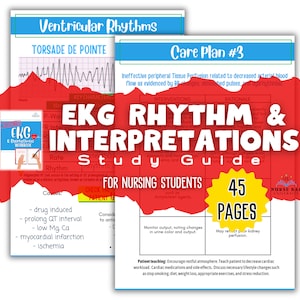 Guide d'étude de l'ECG pour les étudiantes en soins infirmiers BLS/ACLS Rhythms, Interventions, Patient Teaching. École d'infirmières et électrocardiogramme pour les ambulanciers paramédicaux. Plans de soins inclus
