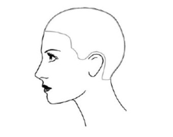 May include: A set of four black and white line drawings of a bald head from different angles. The head is facing forward, to the side, and from the back.