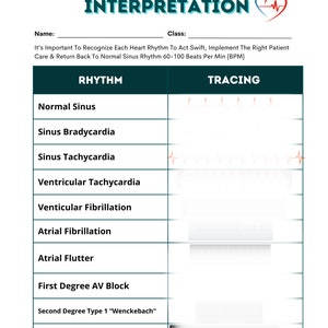 May include: A white ECG interpretation chart with the title "ECG INTERPRETATION" in teal. The chart includes sections for rhythm and tracing, with examples like "Normal Sinus" and "Sinus Bradycardia". The text "It's Important To Recognize Each Heart Rhythm To Act Swift" is also present.