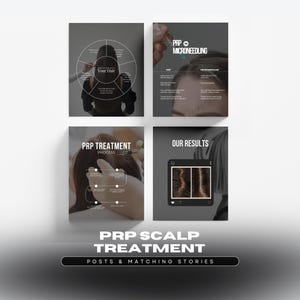 PRP Scalp Treatment Instagram Templates: Hair Loss Posts and Stories, Trychologist, Dermatologist (Digital Download)