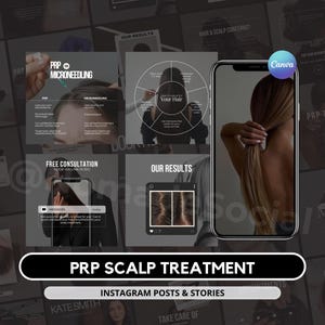 Publicación de Instagram sobre tratamiento del cuero cabelludo con PRP I Plantillas para la pérdida del cabello con PRP I Clínica para la pérdida del cabello I Instagram de Medspa I Publicación de tricólogo I Publicación de Instagram sobre PRP