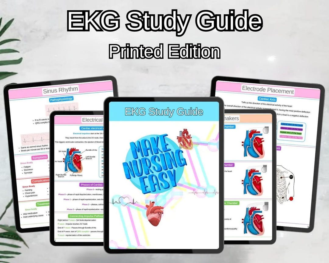 EKG Study Guide - Printed Edition - Etsy