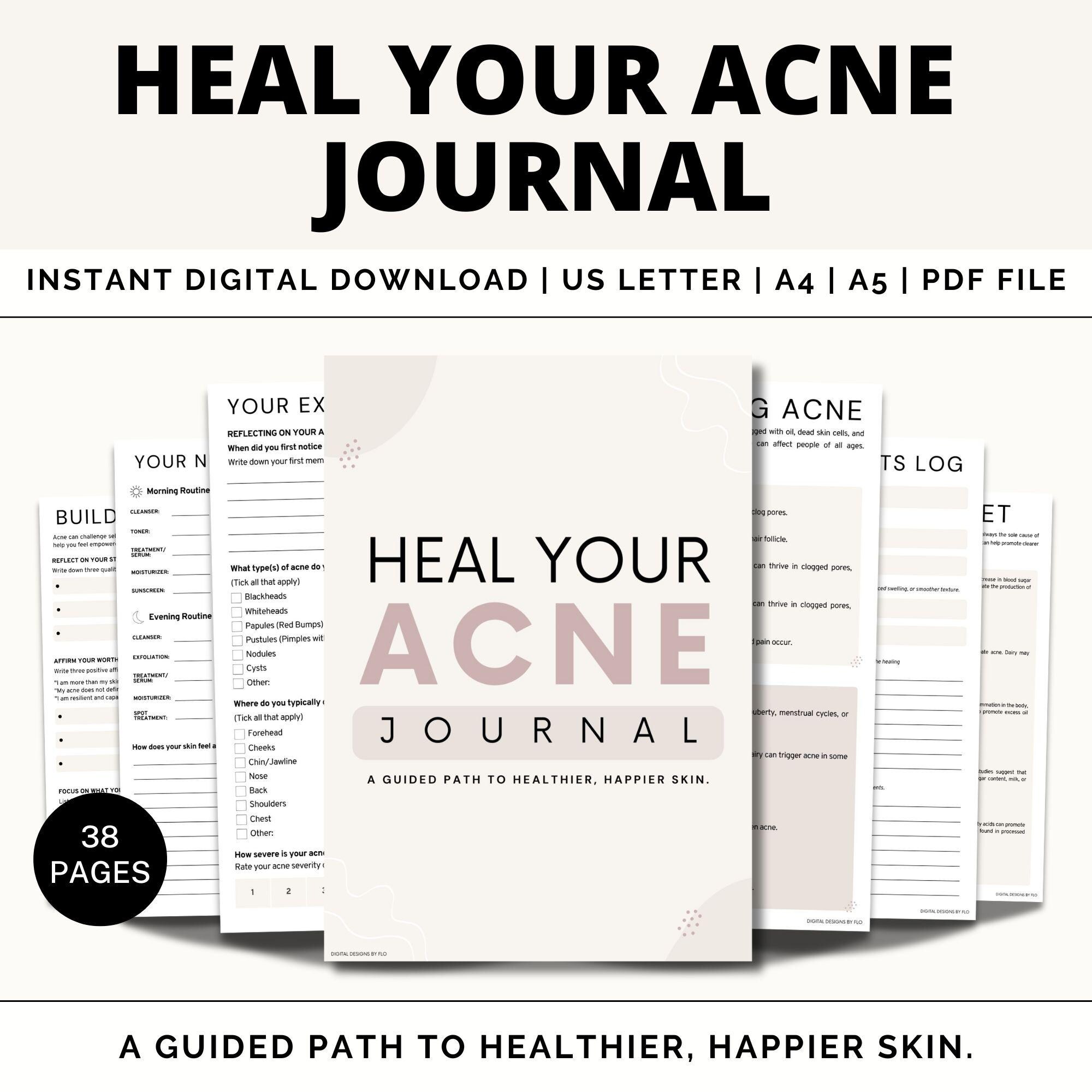 Skin Care Journal, Skin Care Tracker, Acne, Self Care, Pimple Tracker, Self Healing, Clear Skin, Confidence Boost, Glow up, Routine, Beauty