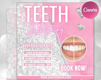 Teeth Whitening Flyer, DIY Flyer Design Template, Dentist Flyer, Teeth Whitening Classes, Teeth Whitening Training, Dentistry Flyer Design
