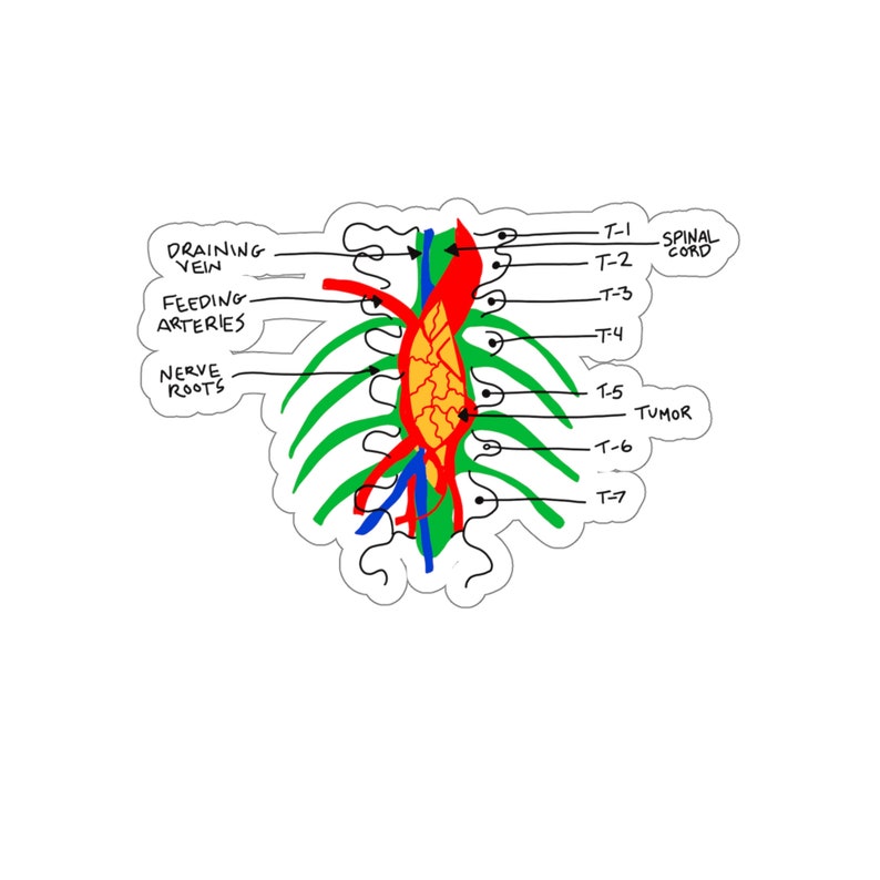 Grey's Anatomy Tumor on the Wall Sticker Etsy