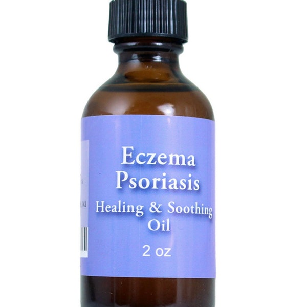 PSORIASIS/ECZEMA RELIEF, Natural Healing Oil, Psoriasis Scalp, All-Natural Remedy, Organic Skin Condition Treatment With Natural Oil Blends