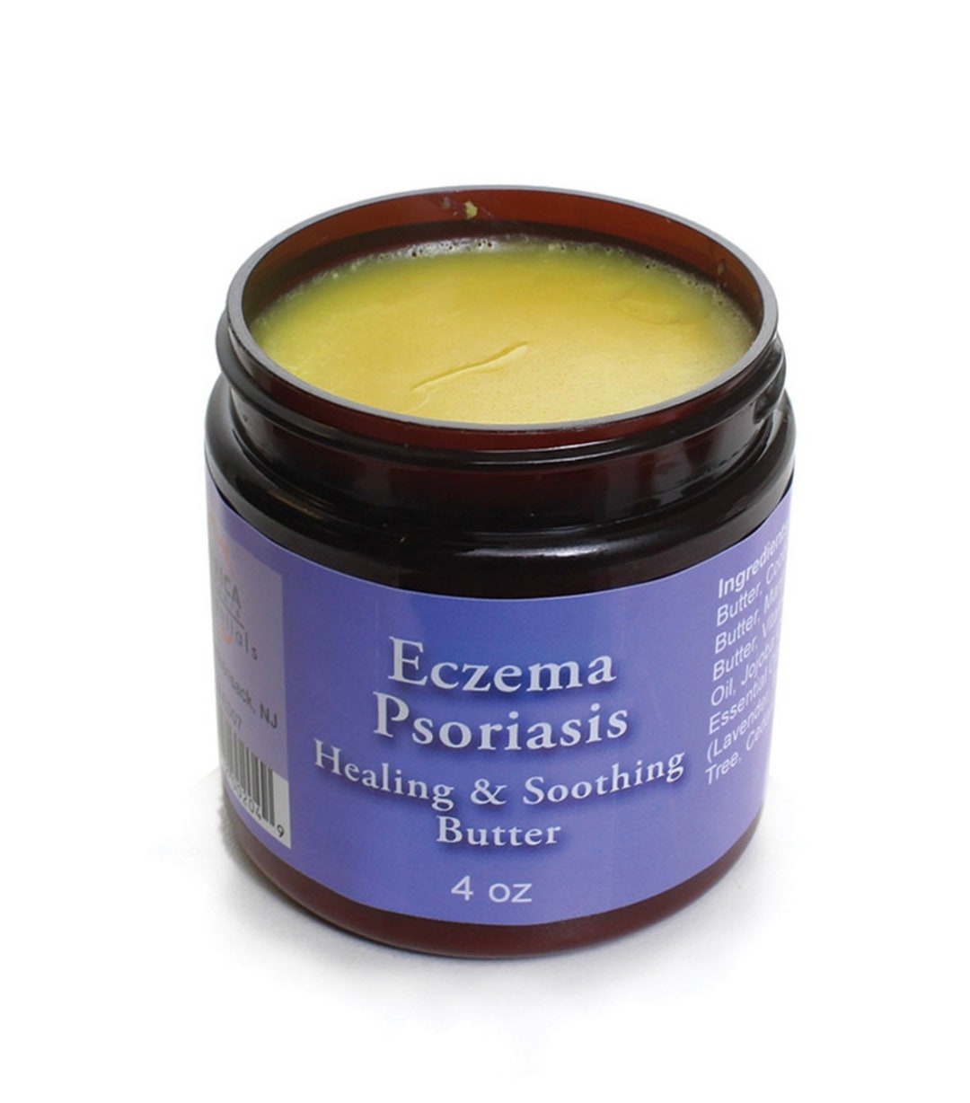 Eczema Relief, Mango Butter, Psoriasis Scalp, Shea Butter, Eczema