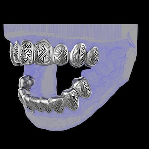 Custom grillz / tooth caps - graffiti cut