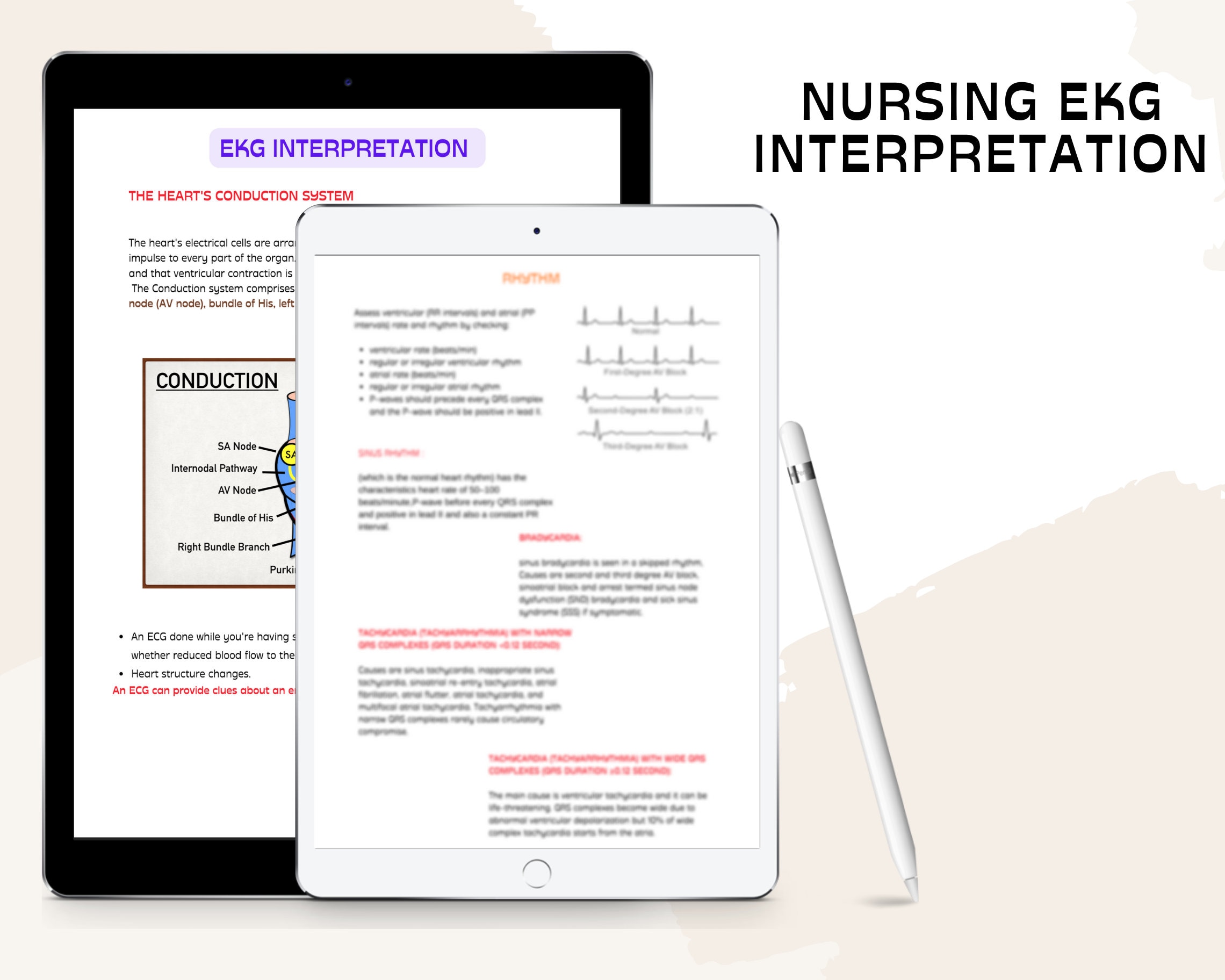 EKG Interpretation Nursing Study Guide – Cardiac Rhythms (digital ...