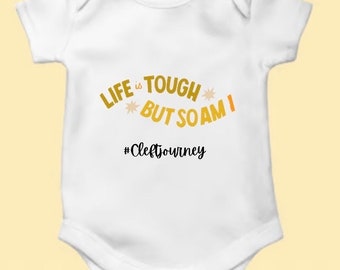 Cleft baby onesie