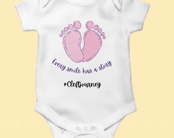 Cleft baby onesie