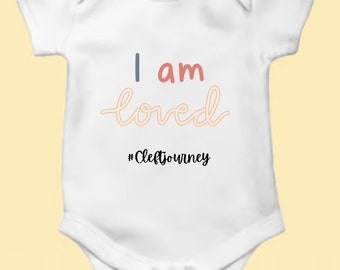 Cleft baby onesie