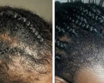 African wild rosemary and mint hair extra strong booster oil