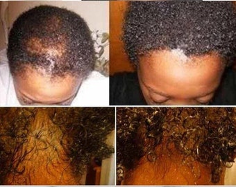 Ginger and Chembe Hair Fertilizer