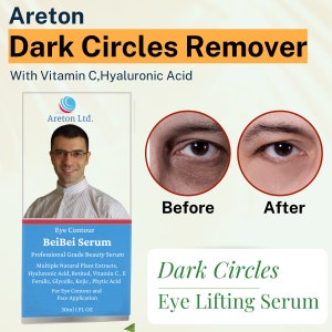 Under Eye Dark circles Remover, Under Eye Dark Circles Treatment , dark spots remover serum, Dark Circles Corrector Cream