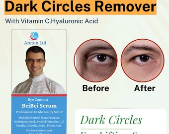 Under Eye Dark circles Remover, Under Eye Dark Circles Treatment , dark spots remover serum, Dark Circles Corrector Cream