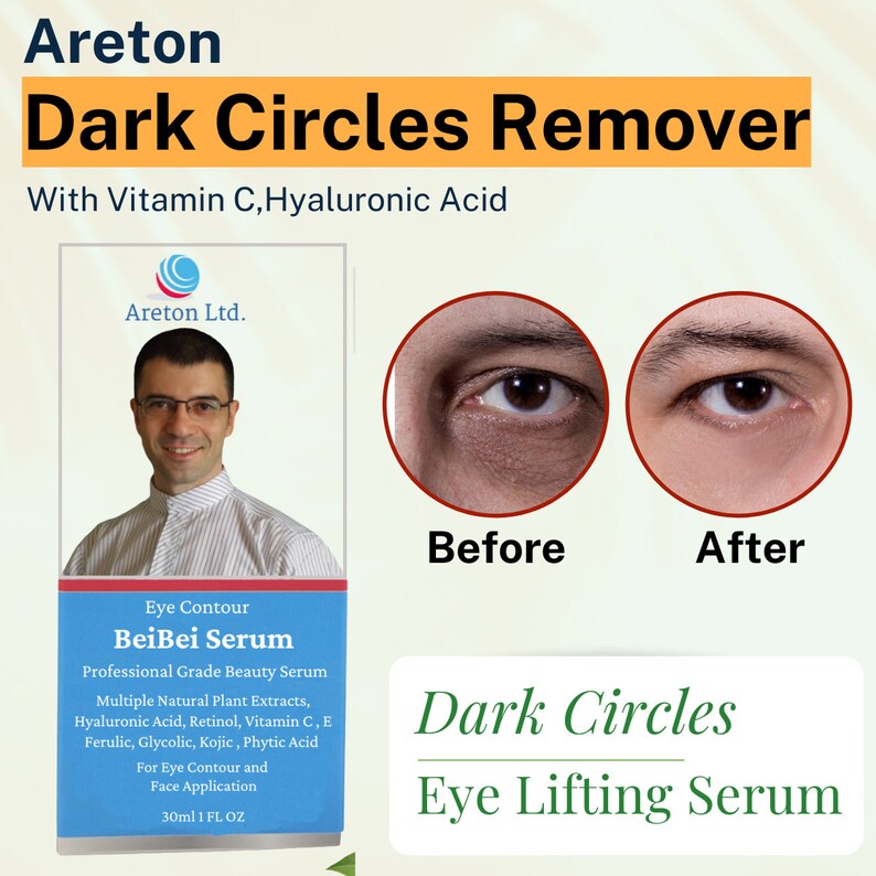 Under Eye Dark Circles Remover, Under Eye Dark Circles Treatment , Dark